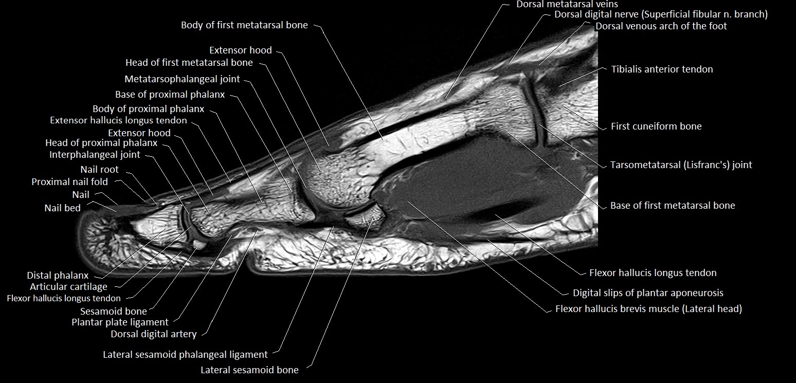 Hallux or big toe sagittal anatomy 3T MRI image 13.webp